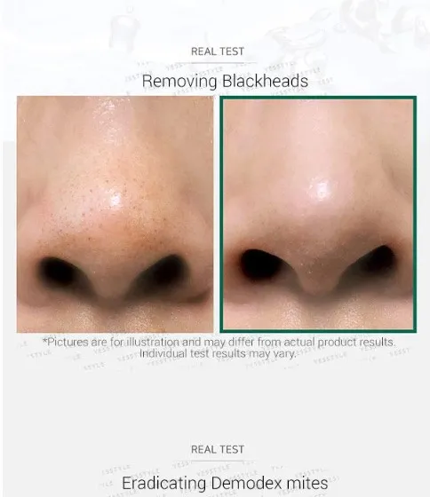 AHA, BHA, PHA 30 Days Miracle Cleansing Bar 1pc - Image 2
