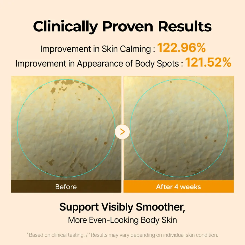 Kojic Acid Turmeric Capsule Body Cream - Image 4
